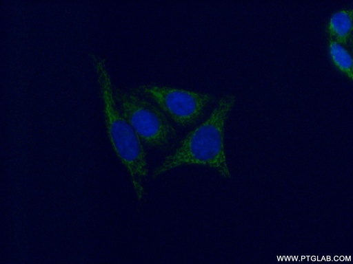 [16766-1-AP-150UL] GSTM4 Polyclonal antibody