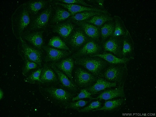 [16768-1-AP-150UL] GLT25D1 Polyclonal antibody