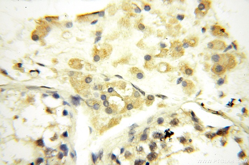[16770-1-AP-20UL] SPAG11A Polyclonal antibody