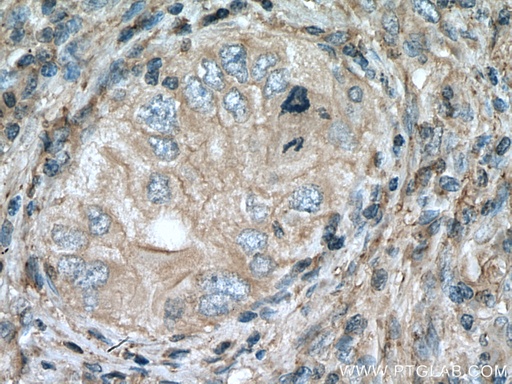 [16775-1-AP-20UL] APOC1 Polyclonal antibody