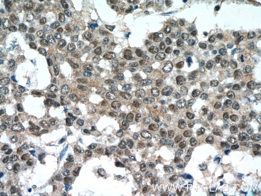 [16777-1-AP-20UL] NEDD8 Polyclonal antibody