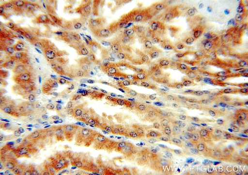 [16781-1-AP-20UL] DcR2 Polyclonal antibody