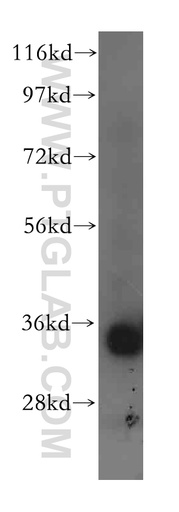[16786-1-AP-150UL] ACY3 Polyclonal antibody