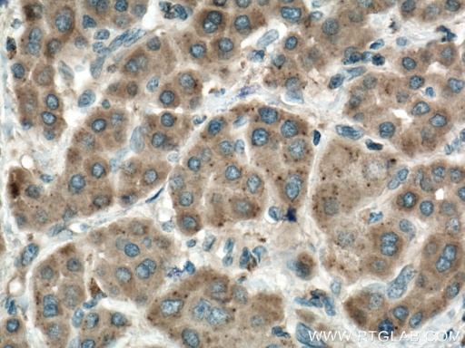 [16790-1-AP-20UL] PRPSAP1 Polyclonal antibody