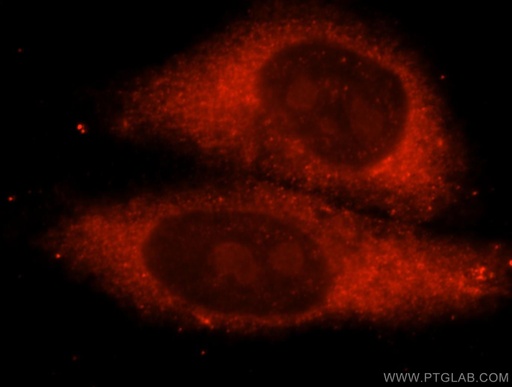[16791-1-AP-20UL] METTL5 Polyclonal antibody