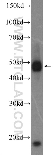 [16802-1-AP-150UL] RNF26 Polyclonal antibody