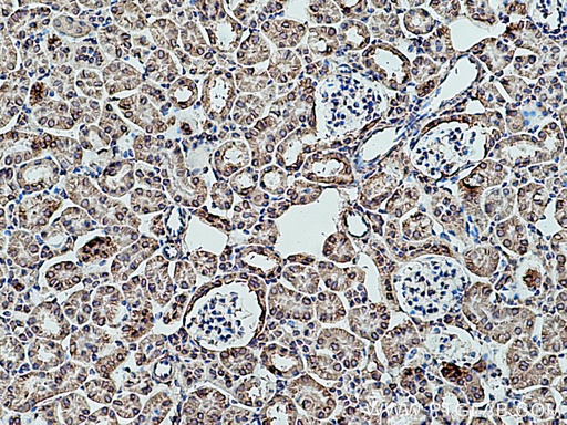 [16805-1-AP-150UL] RPLP2 Polyclonal antibody