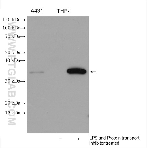 [16806-1-AP-150UL] IL-1 Beta Polyclonal antibody