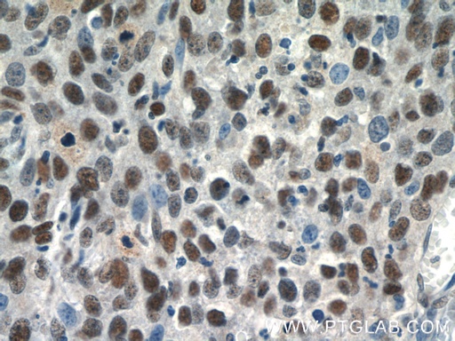 [16807-1-AP-20UL] SNRPB Polyclonal antibody