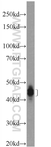 [16808-1-AP-20UL] Dematin Polyclonal antibody