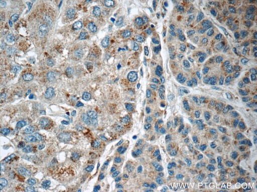 [16812-1-AP-20UL] LMF1 Polyclonal antibody