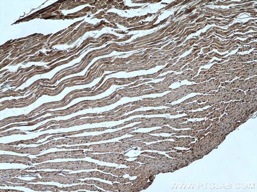[16813-1-AP-150UL] HSP20 Polyclonal antibody