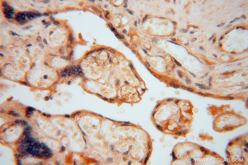 [16814-1-AP-20UL] HIP1R Polyclonal antibody