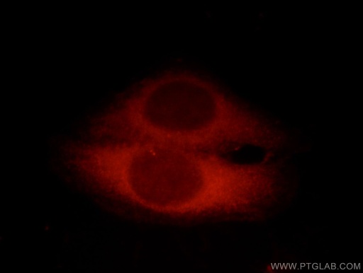 [16816-1-AP-20UL] CC2D1A Polyclonal antibody
