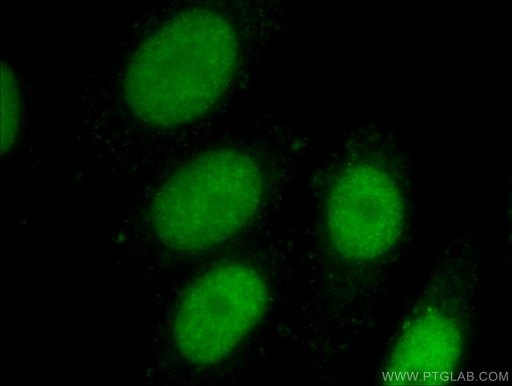 [16818-1-AP-150UL] EED Polyclonal antibody