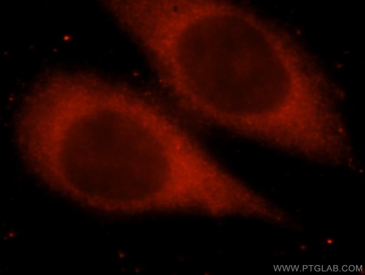 [16822-1-AP-150UL] SPR Polyclonal antibody