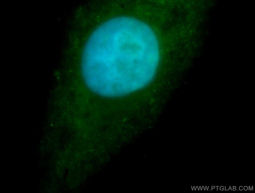 [16823-1-AP-20UL] RBM26 Polyclonal antibody