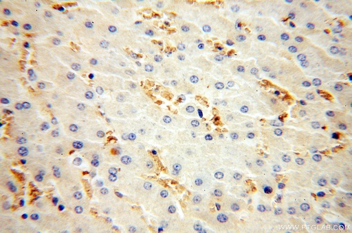 [16824-1-AP-20UL] HBD Polyclonal antibody