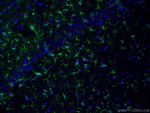 [16825-1-AP-150UL] GFAP Polyclonal antibody