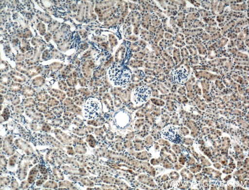 [16827-1-AP-150UL] CNRIP1 Polyclonal antibody