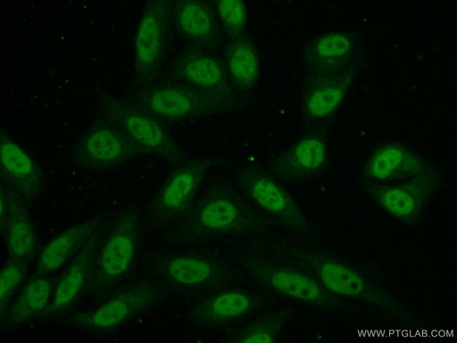 [16828-1-AP-20UL] NCAPD3 Polyclonal antibody