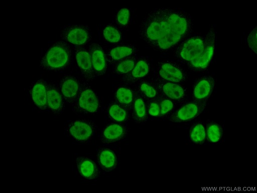 [16830-1-AP-20UL] NIP30 Polyclonal antibody