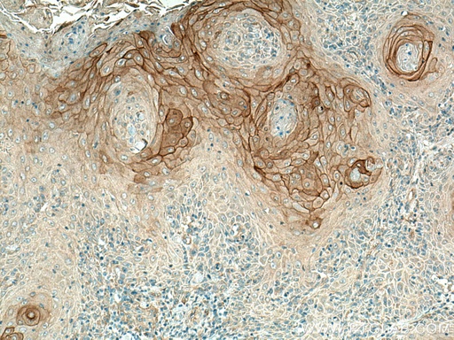 [16835-1-AP-150UL] KRT80 Polyclonal antibody