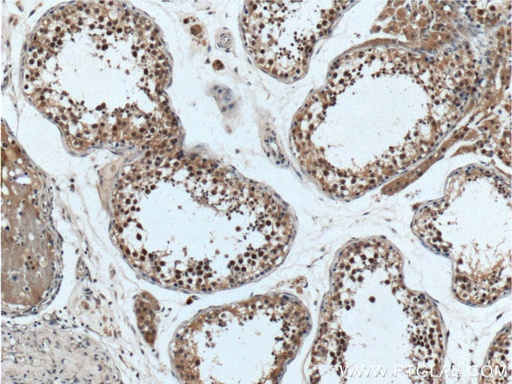 [16837-1-AP-150UL] ALKBH5 Polyclonal antibody