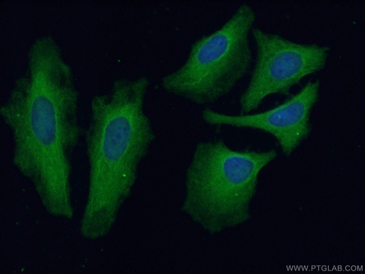 [16840-1-AP-150UL] USP13 Polyclonal antibody