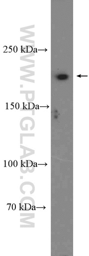 [16841-1-AP-150UL] SETBP1 Polyclonal antibody