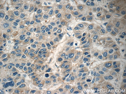 [16842-1-AP-150UL] HEBP1 Polyclonal antibody