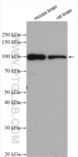 [16843-1-AP-20UL] JAKMIP2 Polyclonal antibody