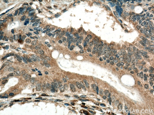 [16846-1-AP-20UL] GPX8 Polyclonal antibody