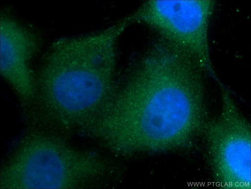 [16848-1-AP-150UL] Cytokeratin 1-specific Polyclonal antibody