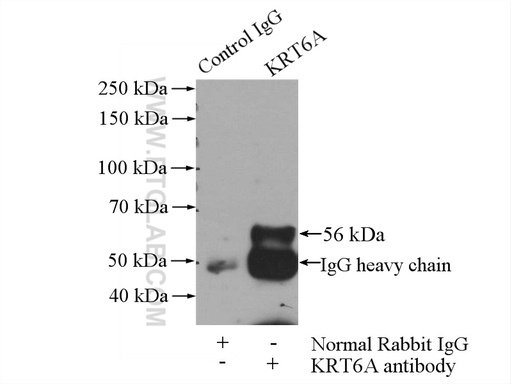 [16853-1-AP-150UL] Cytokeratin 6A-specific Polyclonal antibody
