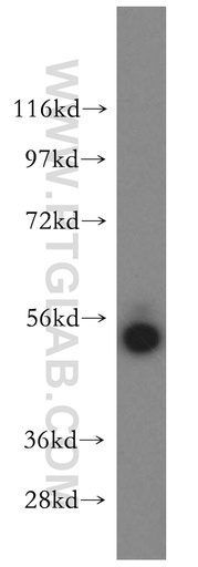 [16861-1-AP-20UL] FMO2-specific Polyclonal antibody
