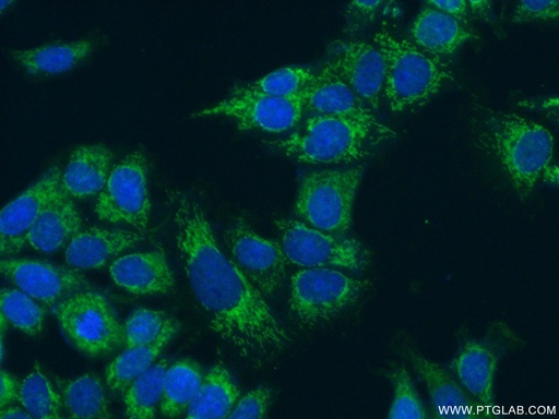 [16864-1-AP-20UL] FMO5-specific Polyclonal antibody