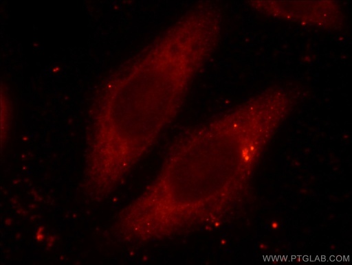 [16865-1-AP-20UL] RAB3A-specific Polyclonal antibody