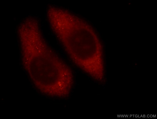 [16867-1-AP-20UL] RAB3C-specific Polyclonal antibody