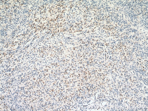 [16868-1-AP-20UL] RAB27A-specific Polyclonal antibody