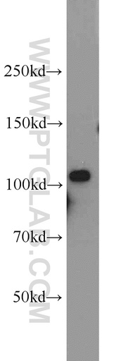 [16871-1-AP-150UL] AMOTL1 Polyclonal antibody