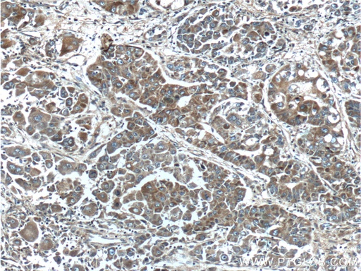 [16874-1-AP-20UL] FGF3-Specific Polyclonal antibody