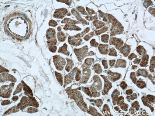 [16876-1-AP-150UL] FGF16-Specific Polyclonal antibody