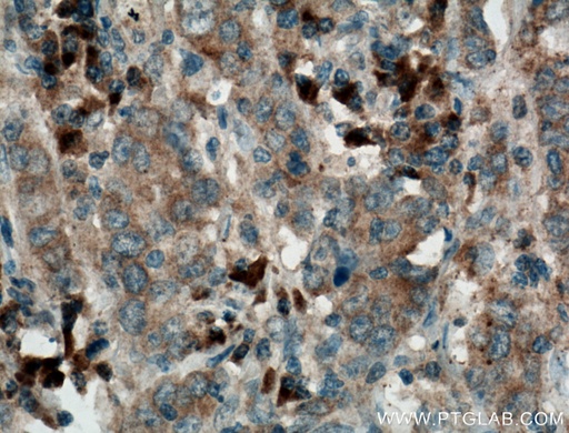 [16881-1-AP-20UL] Pepsinogen II Polyclonal antibody