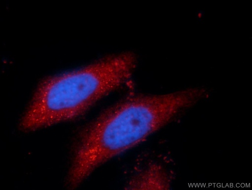[16883-1-AP-20UL] SPAG16 Polyclonal antibody