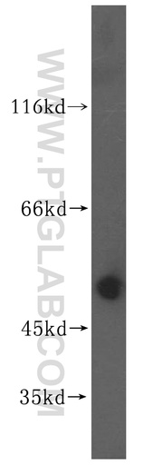 [16885-1-AP-20UL] ZNHIT2 Polyclonal antibody