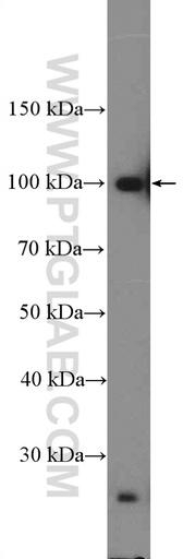 [16887-1-AP-150UL] TSR1 Polyclonal antibody