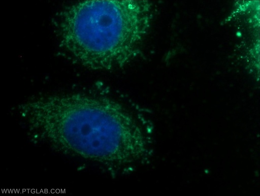 [16888-1-AP-20UL] MTCH2 Polyclonal antibody