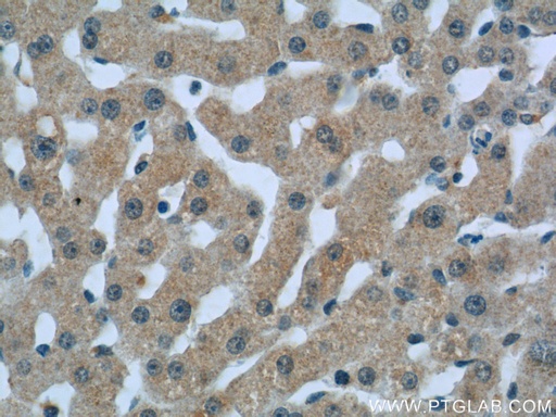 [16889-1-AP-20UL] C1qC Polyclonal antibody