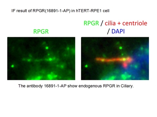 [16891-1-AP-150UL] RPGR Polyclonal antibody